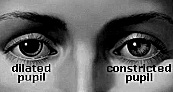 pupils